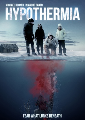 ʧ֢ Hypothermia