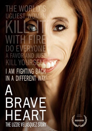 ¸ҵģά˹ȵĹ A Brave Heart: The Lizzie Velasquez Story