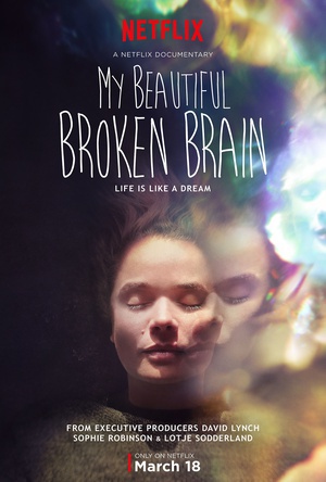 Ĵ My Beautiful Broken Brain